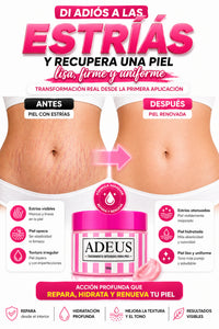 ✨ ADEUS™: CREAM ORIGINAL DE FÓRMULA AVANZADA QUE TRANSFORMA TU PIEL Y REDUCE LA CELULITIS DESDE LA PRIMERA APLICACIÓN 💖🔥
